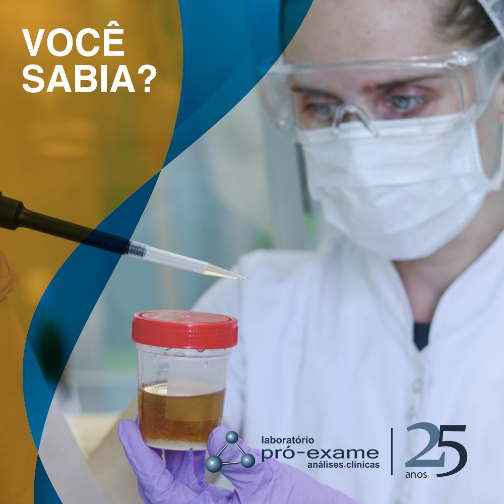 Exame de urina com cultura