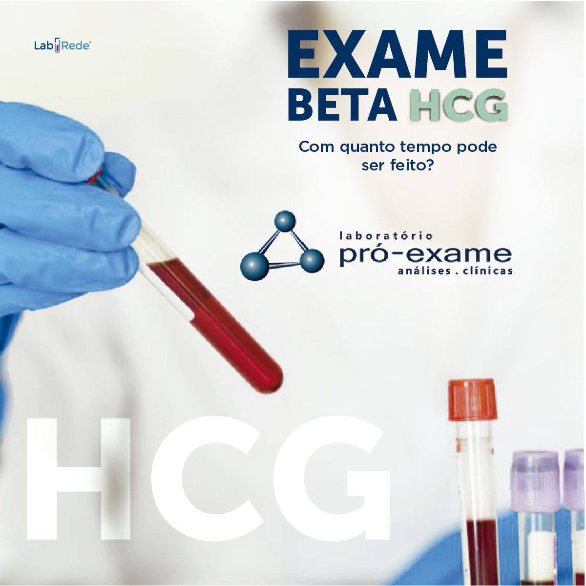 EXAME BETA HCG