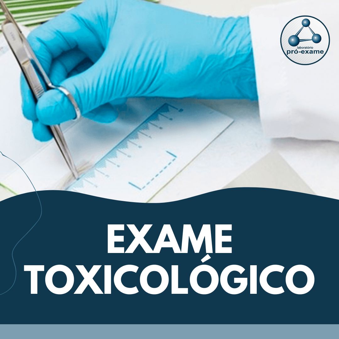 Exame Toxicológico