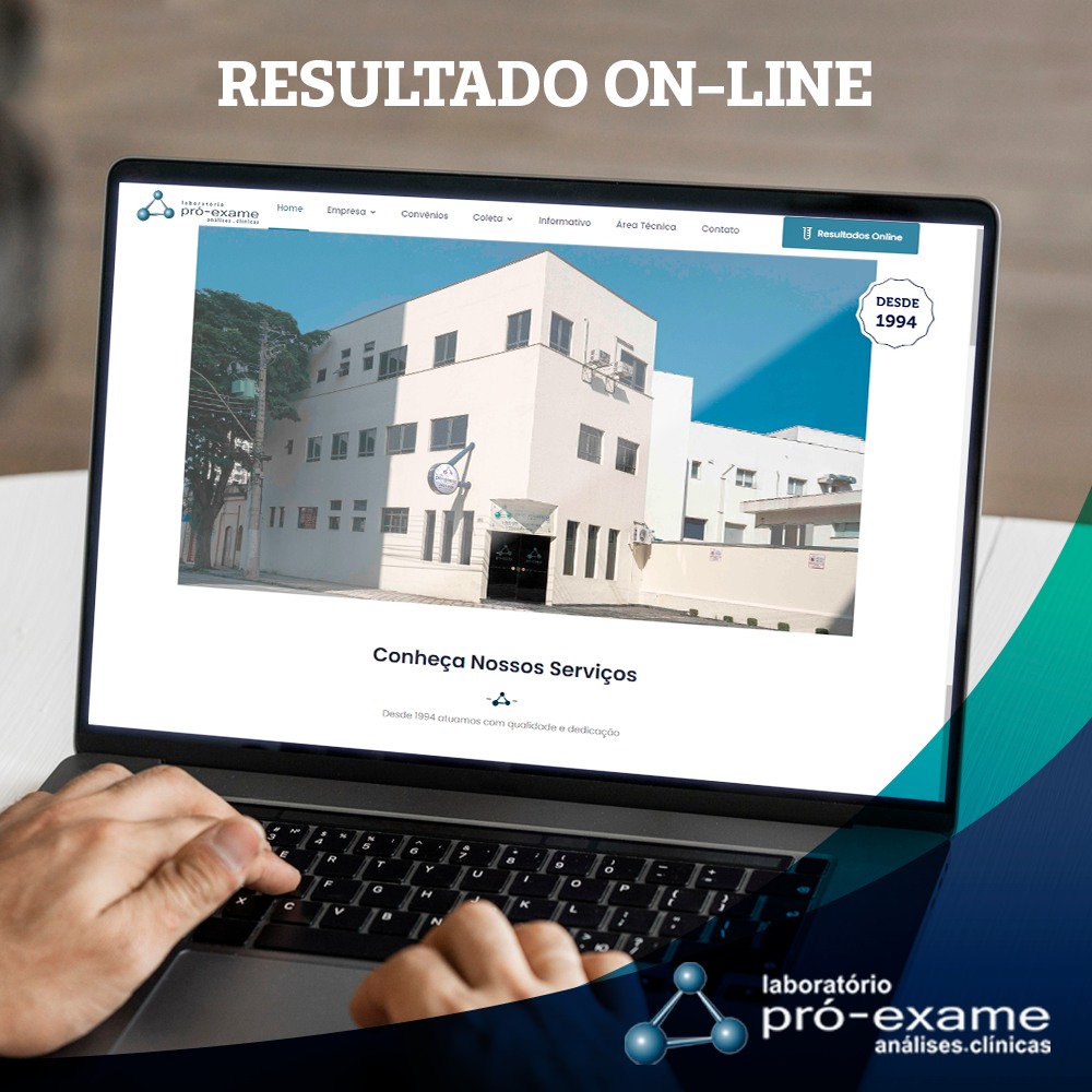RESULTADO ON-LINE