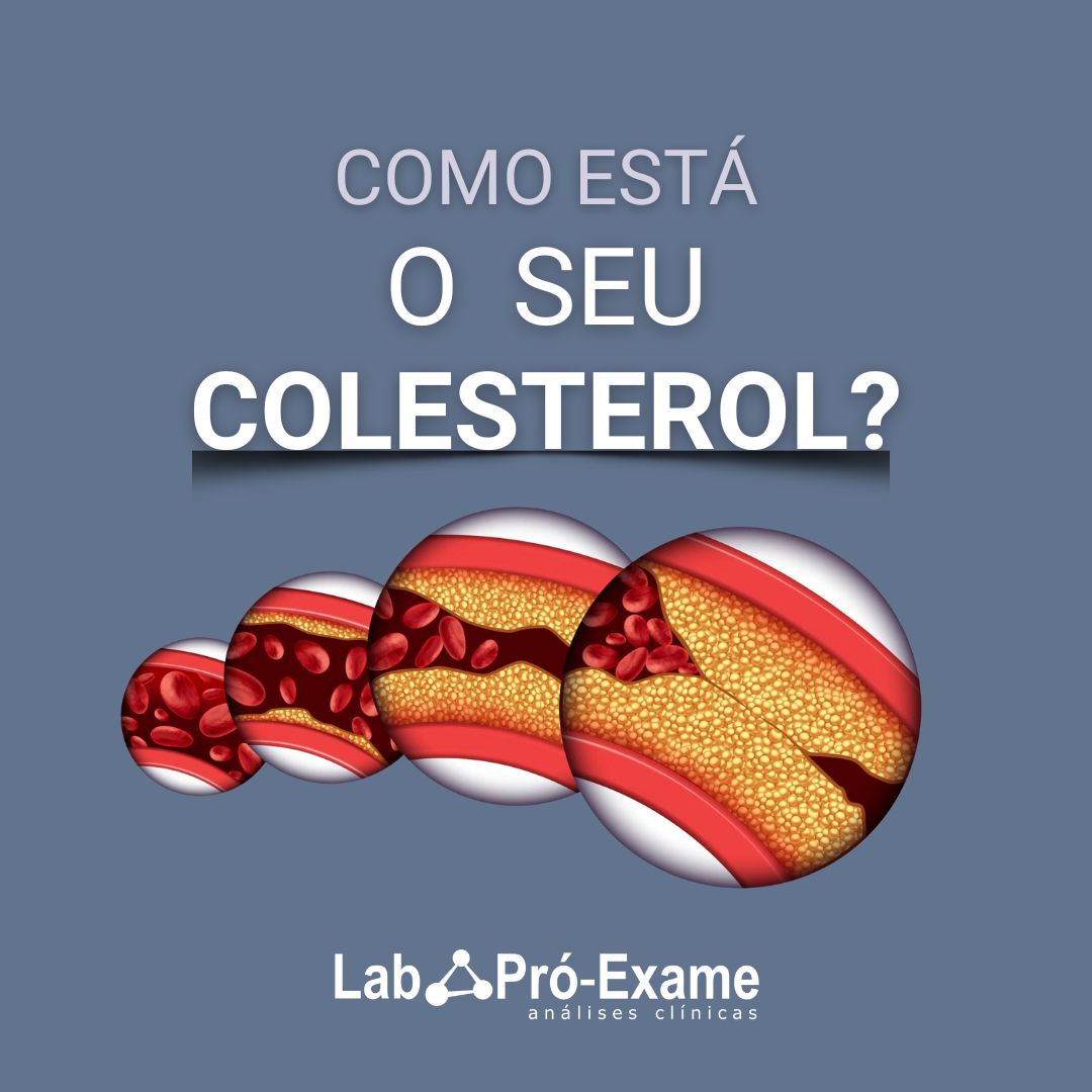 Colesterol 